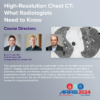 High-Resolution Chest CT: What Radiologists Need To Know