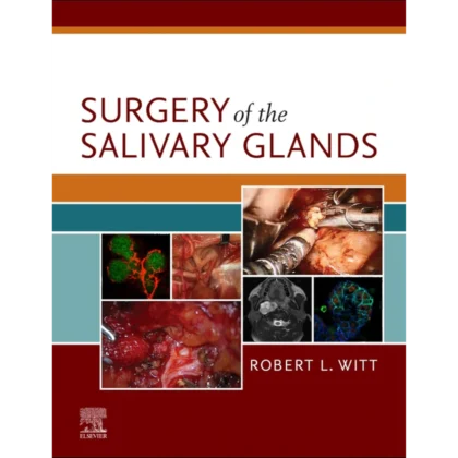 Surgery of the Salivary Glands