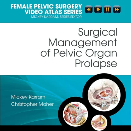 Surgical Management of Pelvic Organ Prolapse: Female Pelvic Surgery Video Atlas Series