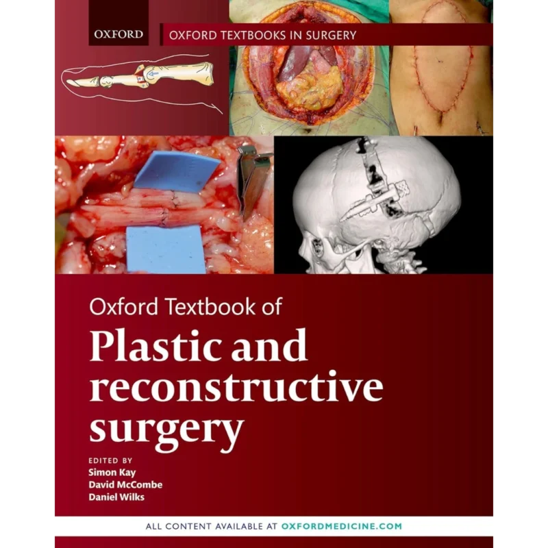 Oxford Textbook of Plastic and Reconstructive Surgery