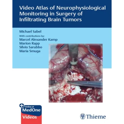 Video Atlas of Neurophysiological Monitoring in Surgery of Infiltrating Brain Tumors