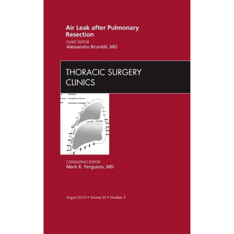 Air Leak after Pulmonary Resection, An Issue of Thoracic Surgery Clinics