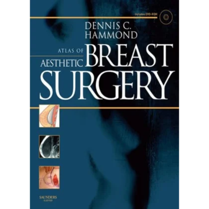 Atlas of Aesthetic Breast Surgery
