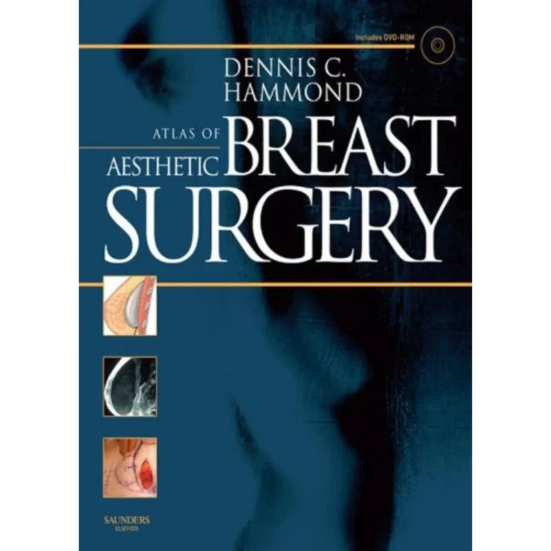 Atlas of Aesthetic Breast Surgery