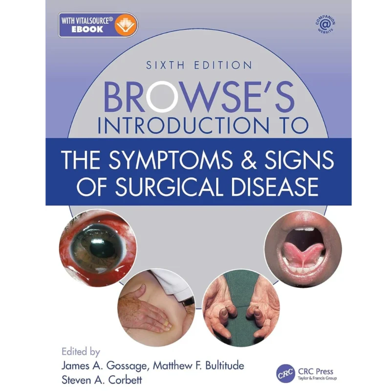 Browse's Introduction to the Symptoms & Signs of Surgical Disease