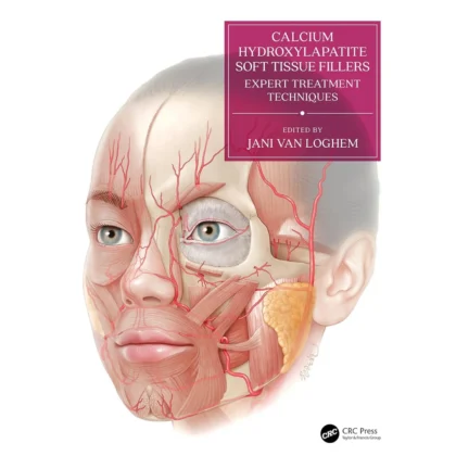 Calcium Hydroxylapatite Soft Tissue Fillers