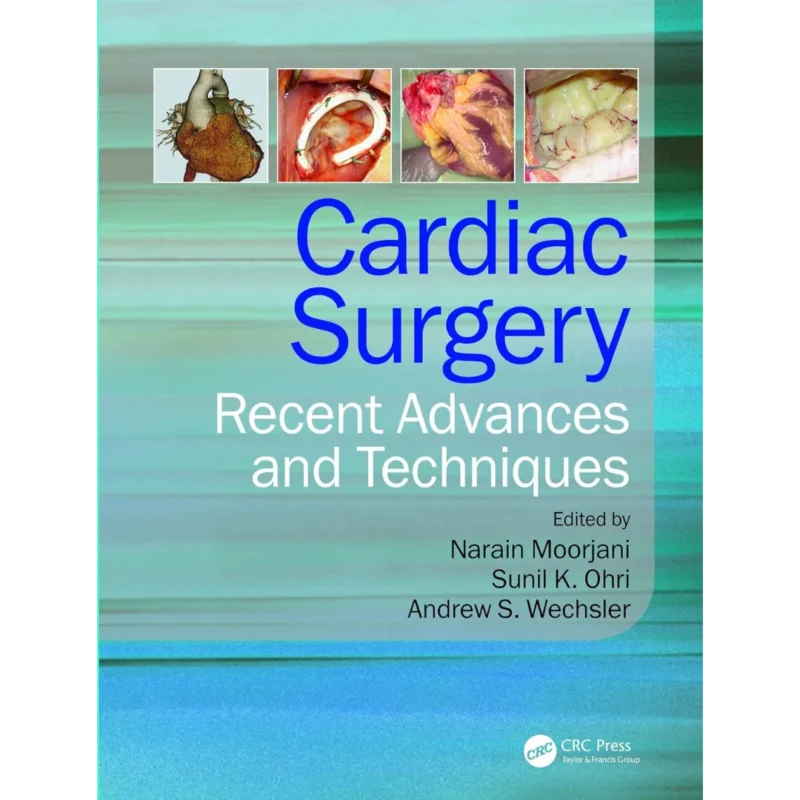 Cardiac Surgery