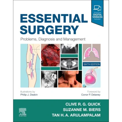 Essential Surgery: Problems, Diagnosis and Management