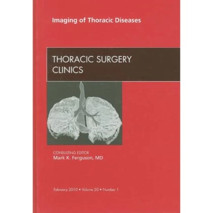 Imaging of Thoracic Diseases, An Issue of Thoracic Surgery Clinics