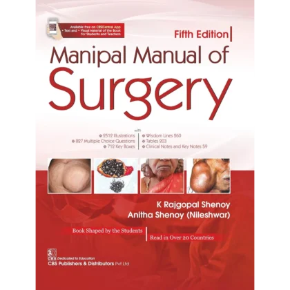 Manipal Manual of Surgery