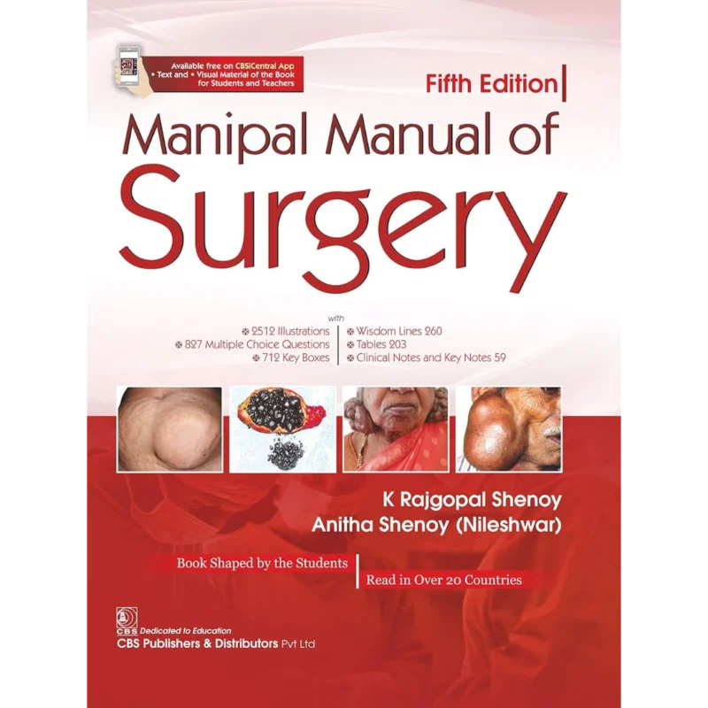Manipal Manual of Surgery