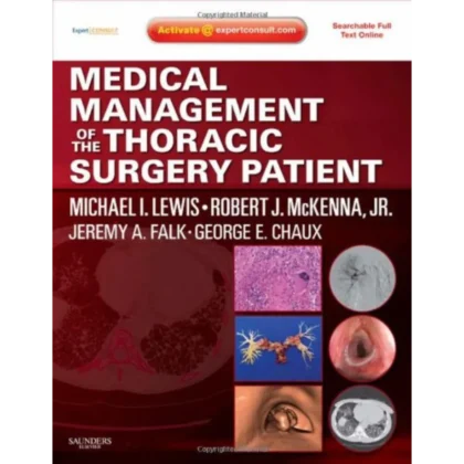 Medical Management of the Thoracic Surgery Patient