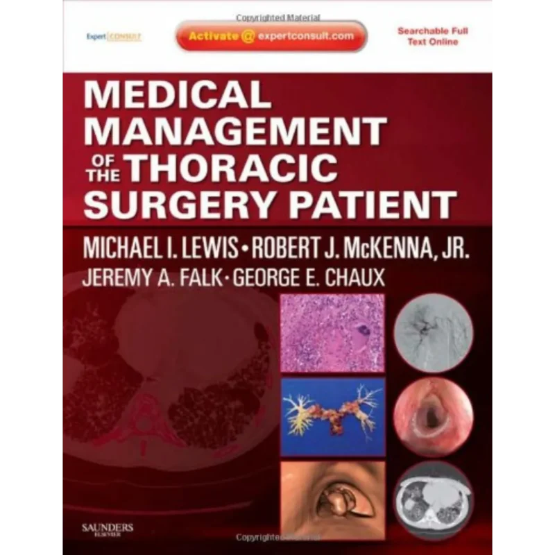 Medical Management of the Thoracic Surgery Patient