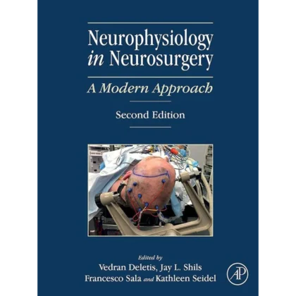 Neurophysiology in Neurosurgery: A Modern Approach