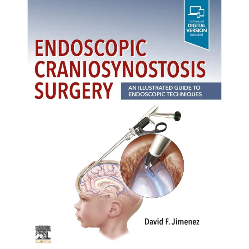 Endoscopic Craniosynostosis Surgery: An Illustrated Guide to Endoscopic Techniques