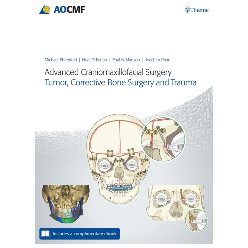 Advanced Craniomaxillofacial Surgery: Tumor, Corrective Bone Surgery, and Trauma