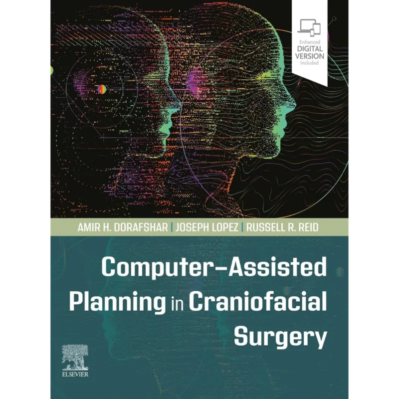 Computer-Assisted Planning in Craniofacial Surgery