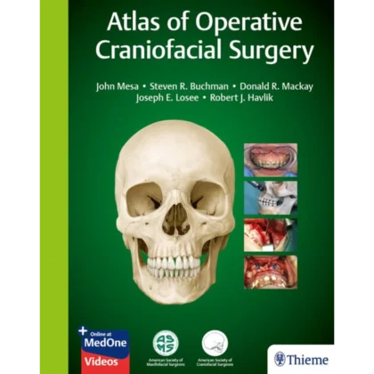 Atlas of Operative Craniofacial Surgery