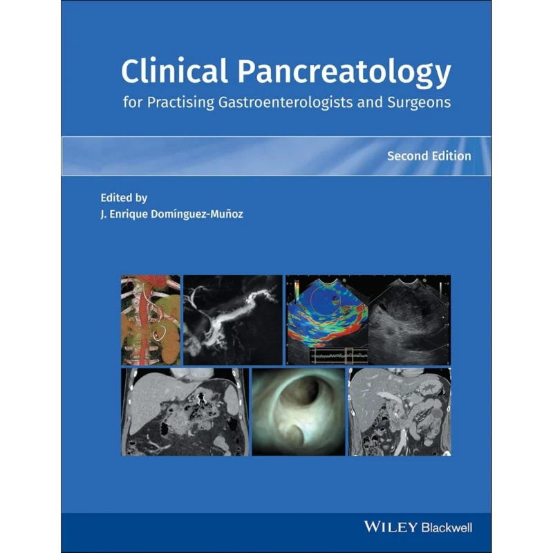 Clinical Pancreatology for Practising Gastroenterologists and Surgeons