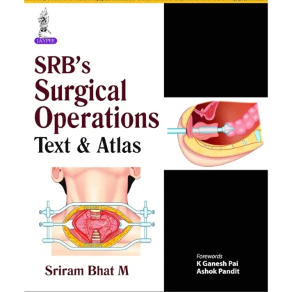 SRB’s Surgical Operations