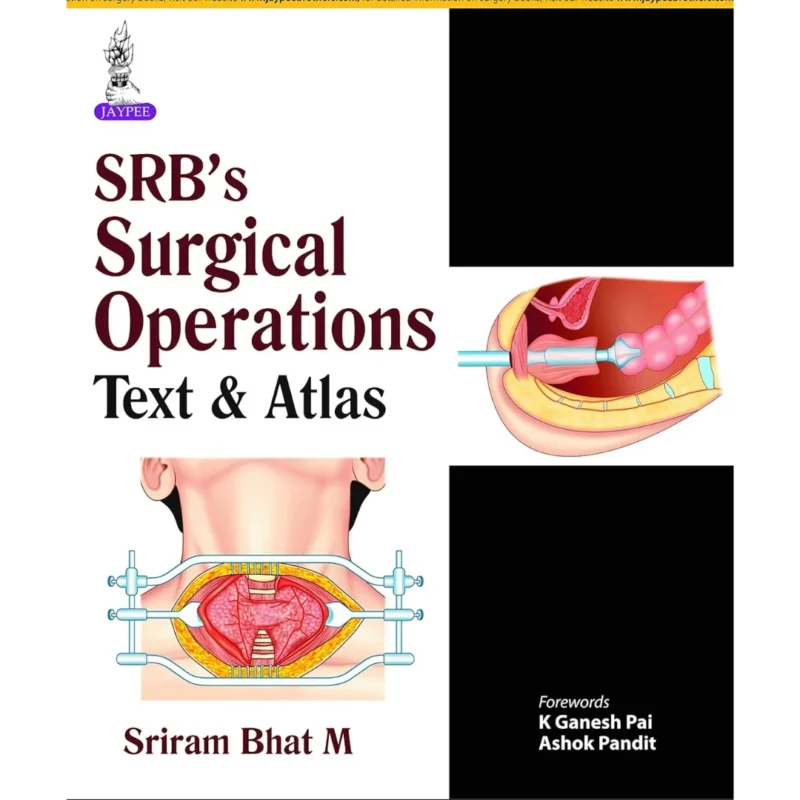 SRB’s Surgical Operations