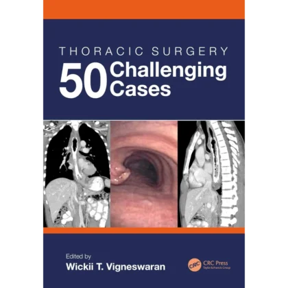 Thoracic Surgery: 50 Challenging cases