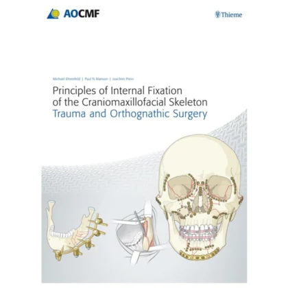Principles of Internal Fixation of the Craniomaxillofacial Skeleton: Trauma and Othognathic Surgery
