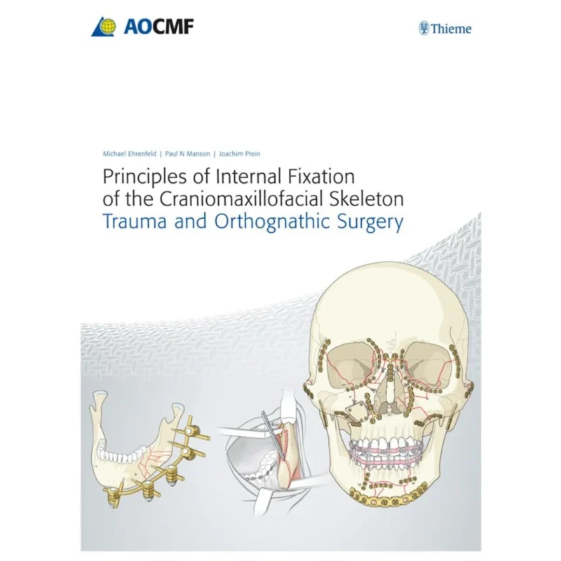 Principles of Internal Fixation of the Craniomaxillofacial Skeleton: Trauma and Othognathic Surgery
