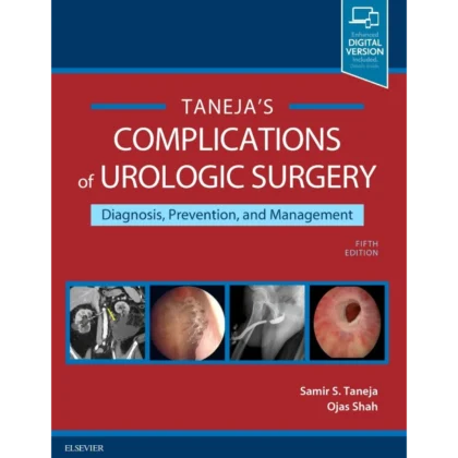 Complications of Urologic Surgery: Prevention and Management