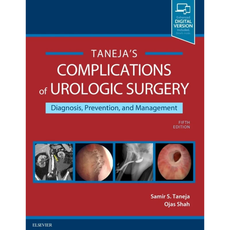 Complications of Urologic Surgery: Prevention and Management