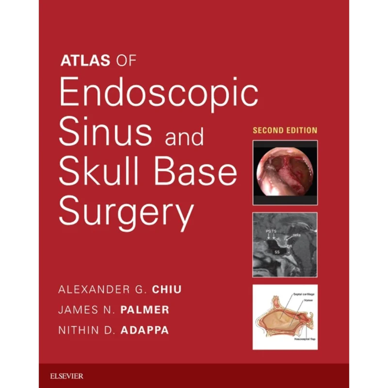 Atlas of Endoscopic Sinus and Skull Base Surgery