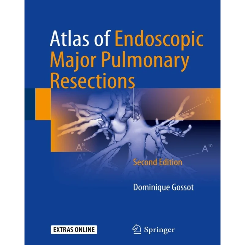 Atlas of Endoscopic Major Pulmonary Resections