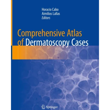 Comprehensive Atlas of Dermatoscopy Cases