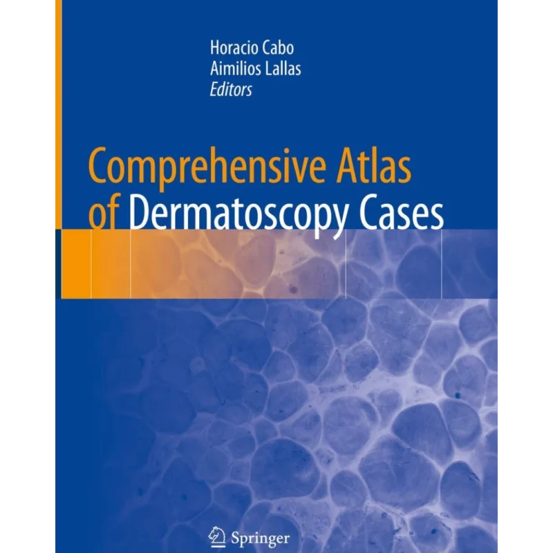 Comprehensive Atlas of Dermatoscopy Cases