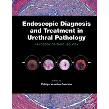 Endoscopic Diagnosis and Treatment in Urethral Pathology: Handbook of Endourology