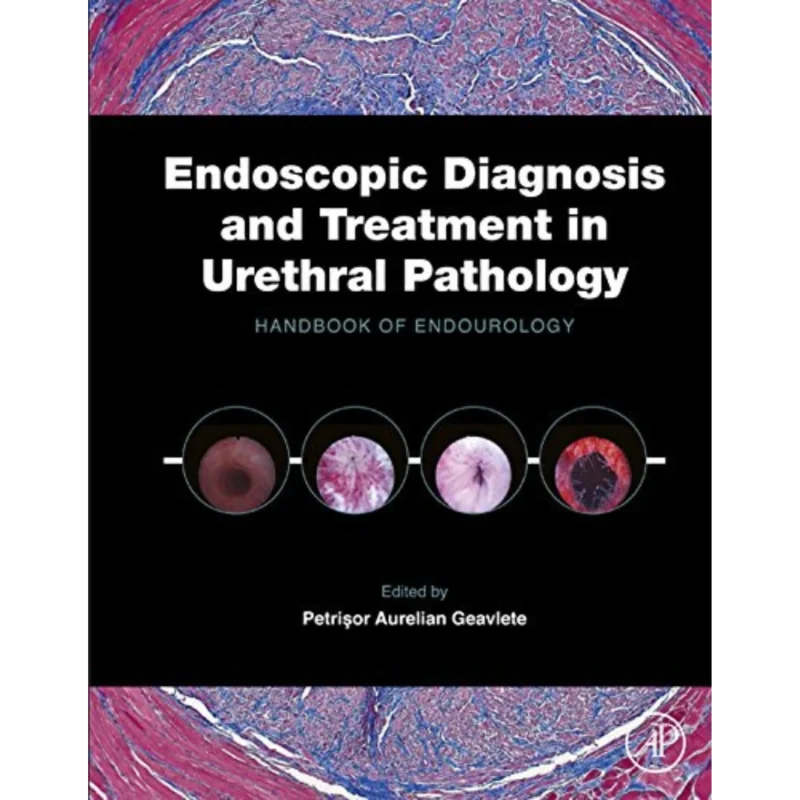 Endoscopic Diagnosis and Treatment in Urethral Pathology: Handbook of Endourology
